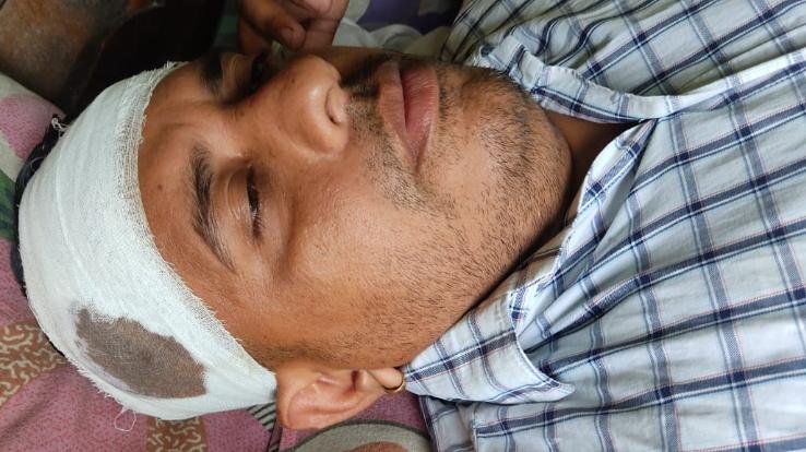 Contract worker beaten with baseball due to a dispute over beer rate