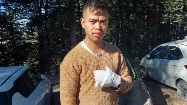 Man injured in leopard attack near Five Bench in Jakhu