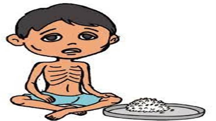 Dharamsala: 437 children suffering from severe malnutrition in Kangra district