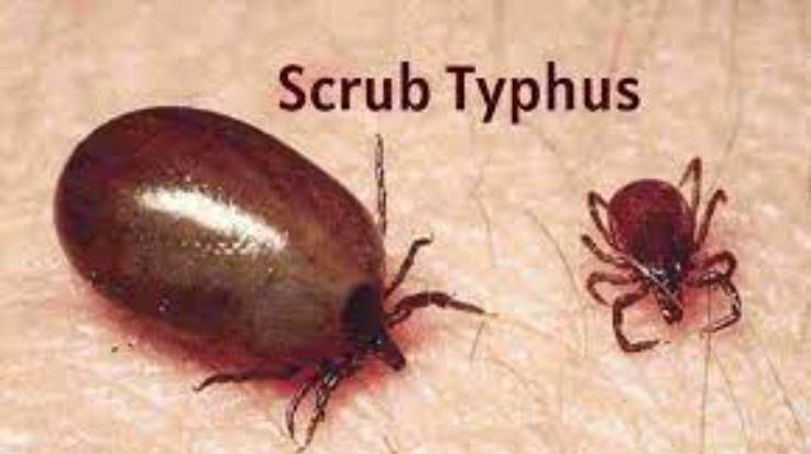  Fourth death due to scrub typhus in IGMC Shimla, 12 new cases