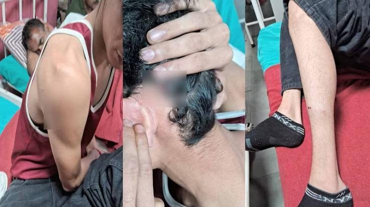 SFI and ABVP workers clash in HPU, cross FIR registered