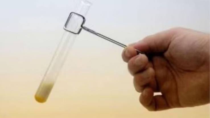 Testing was done in CDL Kasauli, sample of tetanus toxoid vaccine failed.