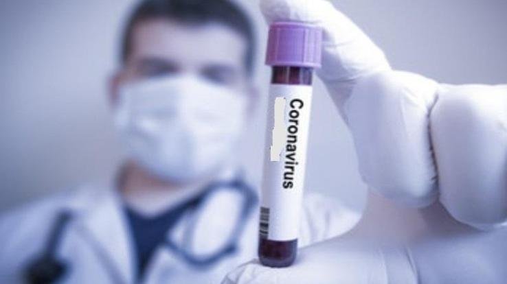 कोरोना संक्रमित व्यक्तियोें के सम्पर्क में आए लोगों की पहचान एवं परीक्षण के लिए सघन अभियान