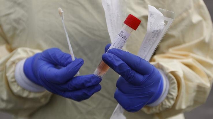 टेस्टिंग और स्क्रीनिंग