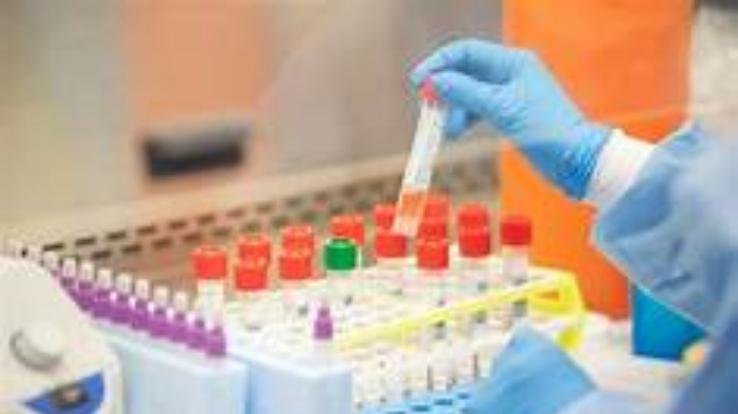 जिला बिलासपुर में 24 कोरोना पाॅजिटिव लोगों का चल रहा इलाज : डाॅ. प्रकाश दरोच