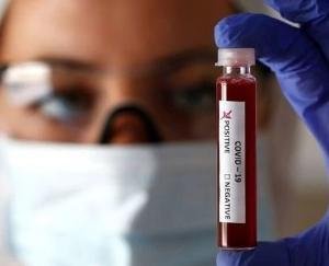 शिमला में कोरोना का बड़ा विस्फोट, रामपुर में आईटीबीपी के 18 जवान सहित 22 पॉजीटिव