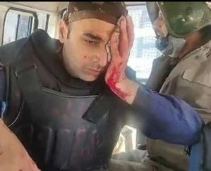 four-policeman-injured-shimla