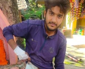 Terror of monkeys in Panchayat Kadoa, young man injured