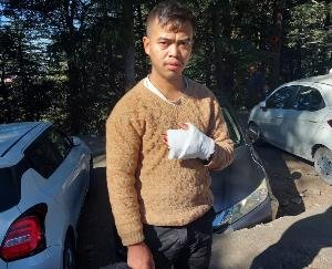 Man injured in leopard attack near Five Bench in Jakhu