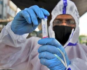 318 new positive cases of corona in the state