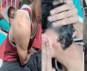 SFI and ABVP workers clash in HPU, cross FIR registered