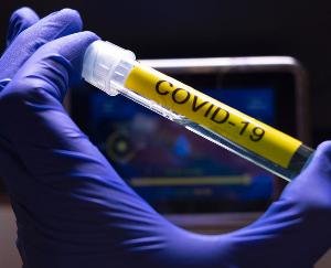 कोविड-19 से बचाव हेतु पूरे सुरक्षा कदम उठा रहा स्वास्थ्य विभाग - डॉ प्रकाश दरोच