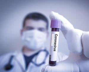 कोरोना संक्रमित व्यक्तियोें के सम्पर्क में आए लोगों की पहचान एवं परीक्षण के लिए सघन अभियान