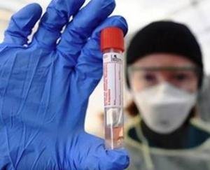 सिर्फ यह है राहत