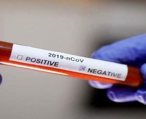 बिलासपुर में अब तक 1885 सैंपल में 1749 सैंपल की रिपोर्ट नेगेटिव