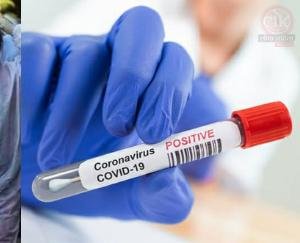 जिला में 2 व्यक्ति आए कोरोना पॉजिटिव 