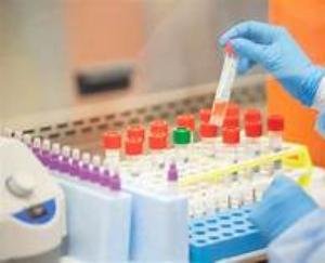 जिला बिलासपुर में 24 कोरोना पॉजिटिव लोगों का चल रहा इलाज : डाॅ. प्रकाश दरोच