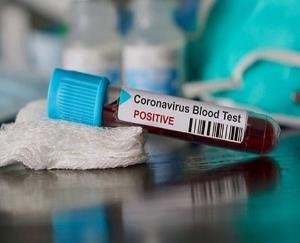 मुख्यमंत्री आवास में एक और चालक कोरोना पॉजिटिव 