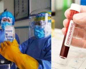 5-people-die-due-to-covid-in-igmc