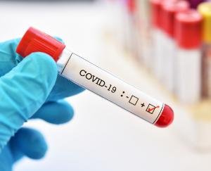 4 people found corona positive in RT-PCR test
