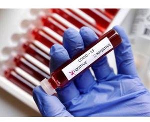 Mandi: Sarkaghat was struck by the havoc of Corona, six cases came together